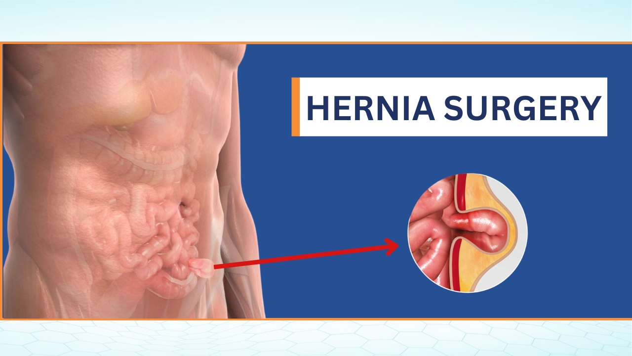 Hernia Surgery Cost in Punjab